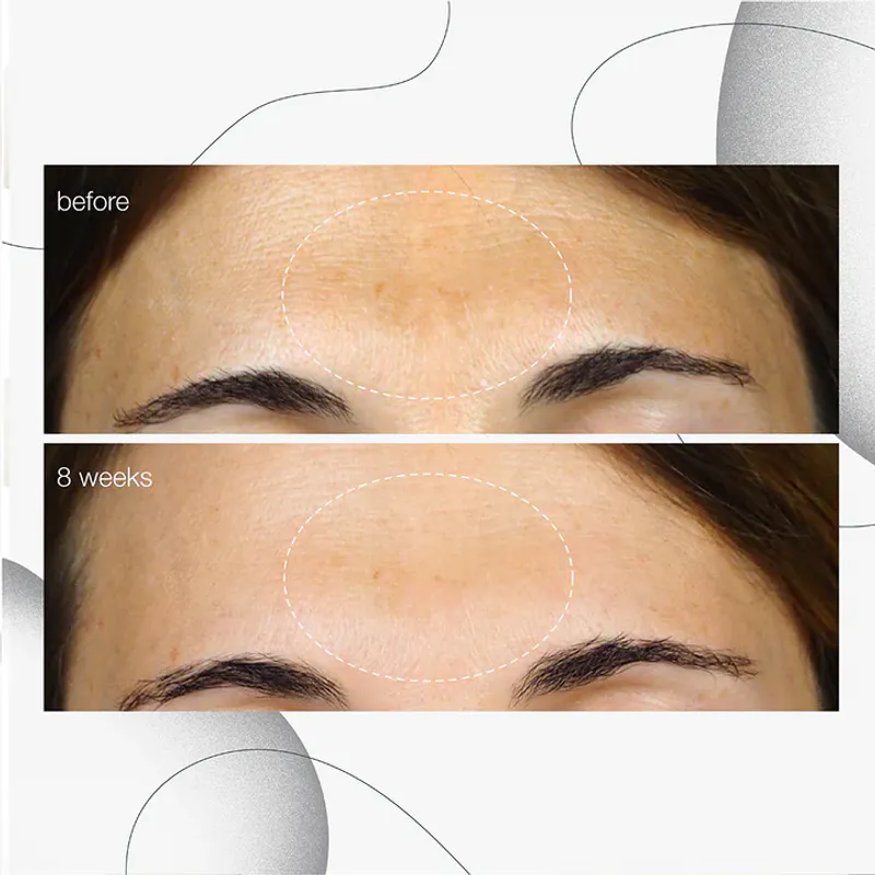 Dark Spot Serum 30ml